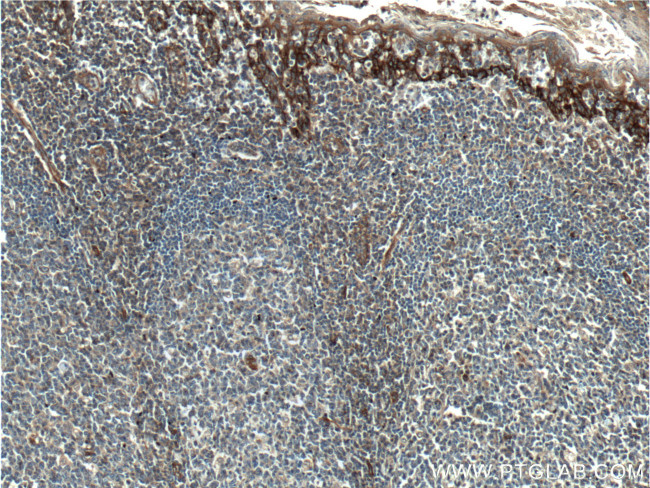 Beta Arrestin 2 Antibody in Immunohistochemistry (Paraffin) (IHC (P))