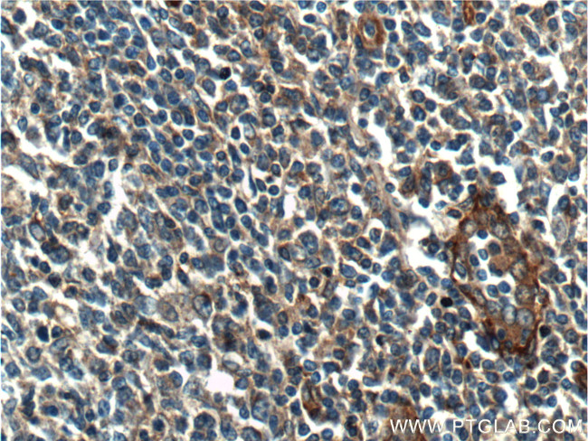 Beta Arrestin 2 Antibody in Immunohistochemistry (Paraffin) (IHC (P))