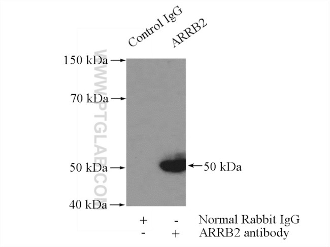 Beta Arrestin 2 Antibody in Immunoprecipitation (IP)