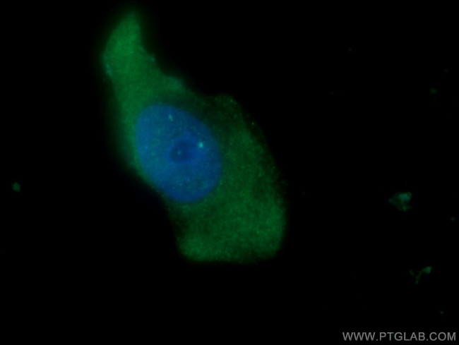 NKIRAS2 Antibody in Immunocytochemistry (ICC/IF)