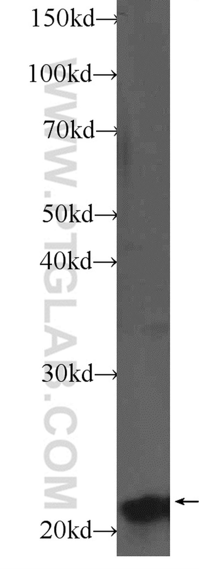 NKIRAS2 Antibody in Western Blot (WB)