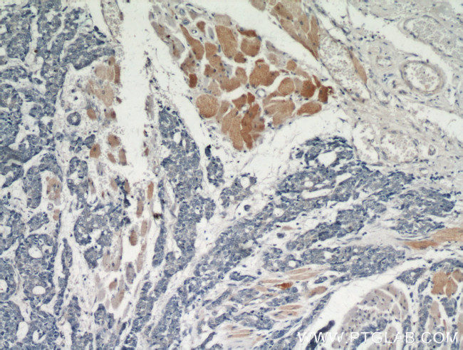 AKT Antibody in Immunohistochemistry (Paraffin) (IHC (P))