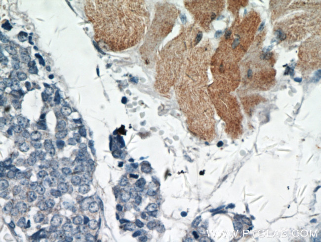 AKT Antibody in Immunohistochemistry (Paraffin) (IHC (P))