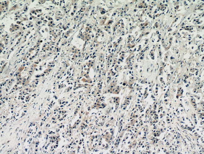 AKT Antibody in Immunohistochemistry (Paraffin) (IHC (P))