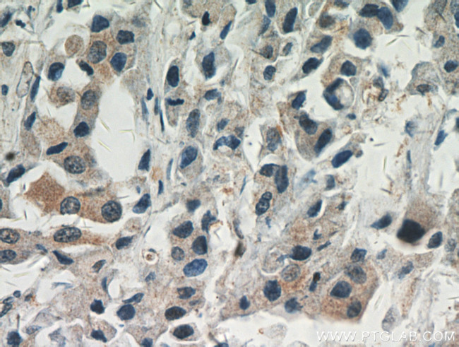 AKT Antibody in Immunohistochemistry (Paraffin) (IHC (P))