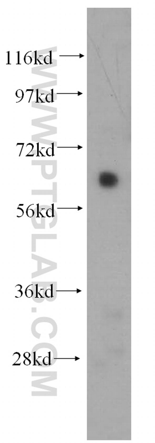 AKT Antibody in Western Blot (WB)