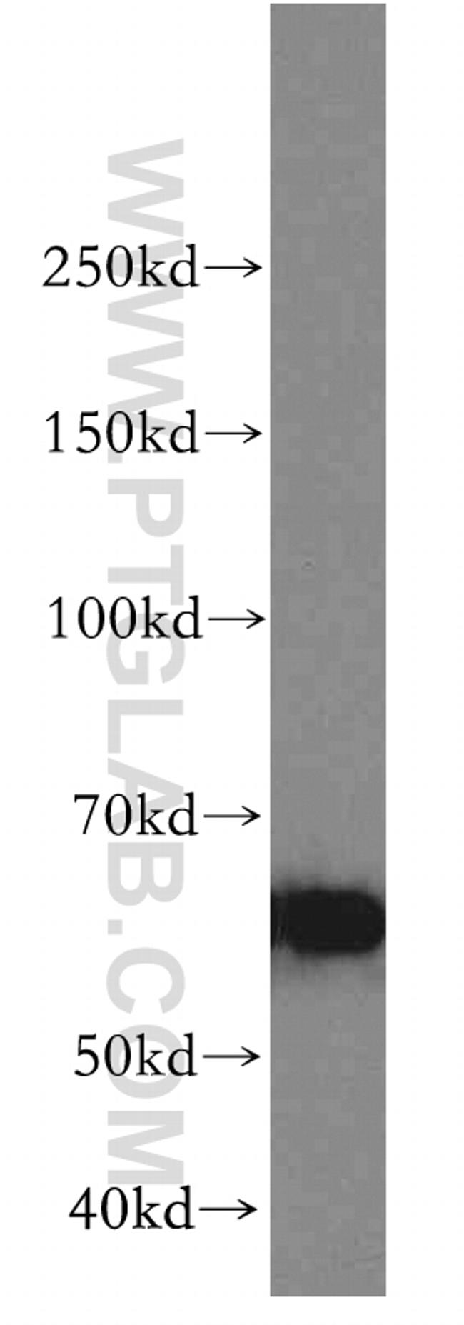 AKT Antibody in Western Blot (WB)