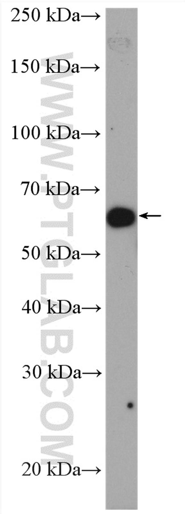 AKT Antibody in Western Blot (WB)