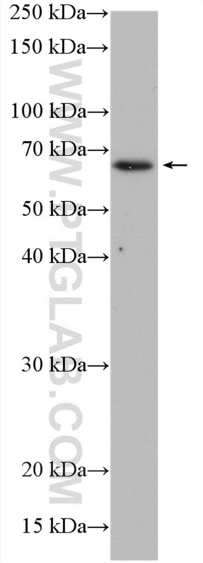 AKT Antibody in Western Blot (WB)