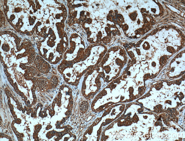 AKT Antibody in Immunohistochemistry (Paraffin) (IHC (P))