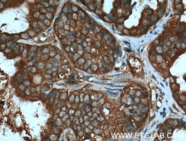 AKT Antibody in Immunohistochemistry (Paraffin) (IHC (P))