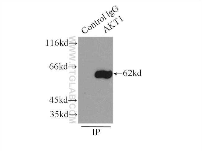 AKT Antibody in Immunoprecipitation (IP)