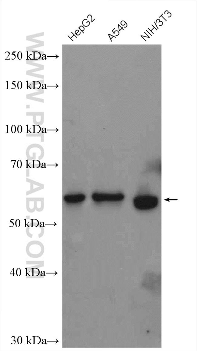 AKT Antibody in Western Blot (WB)