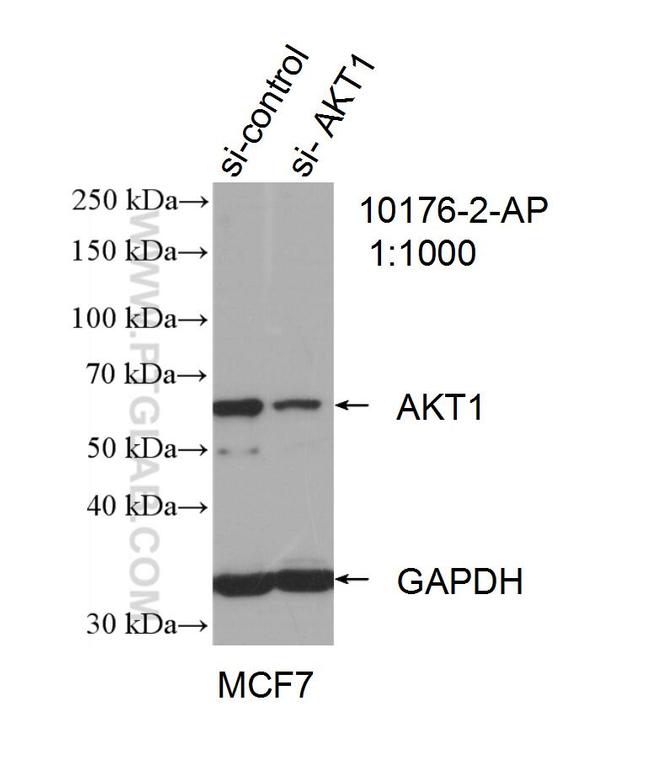 AKT Antibody in Western Blot (WB)