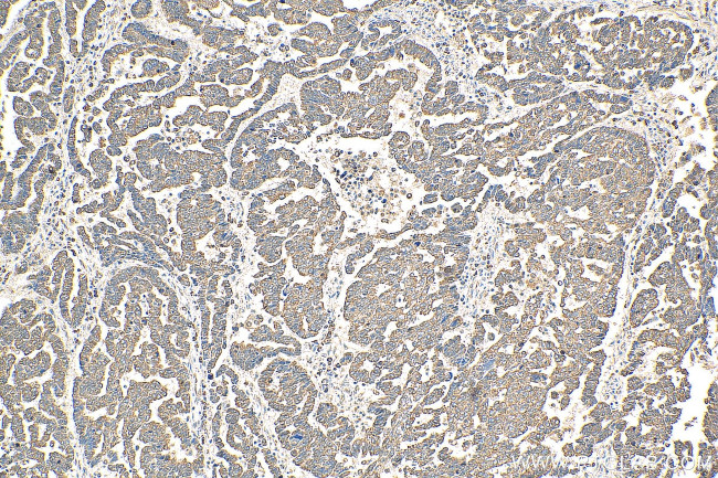 AKT Antibody in Immunohistochemistry (Paraffin) (IHC (P))