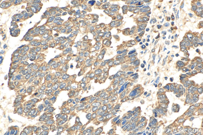 AKT Antibody in Immunohistochemistry (Paraffin) (IHC (P))