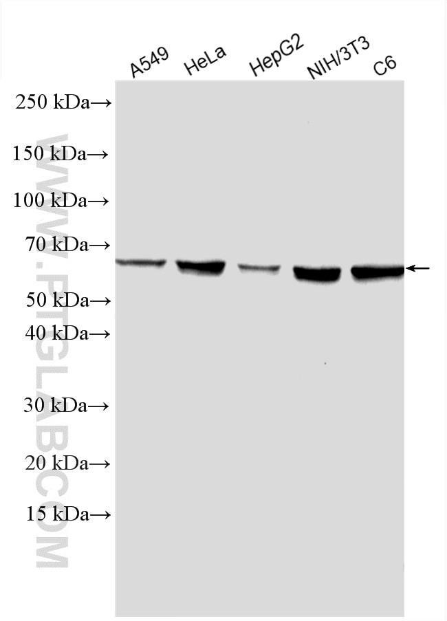 AKT Antibody in Western Blot (WB)