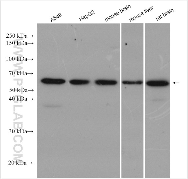 AKT Antibody in Western Blot (WB)