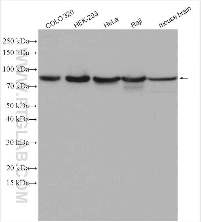 Mitofilin Antibody in Western Blot (WB)