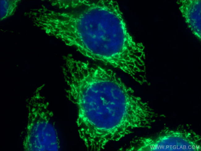 Mitofilin Antibody in Immunocytochemistry (ICC/IF)