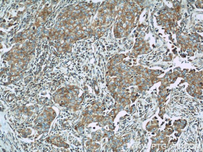 Mitofilin Antibody in Immunohistochemistry (Paraffin) (IHC (P))