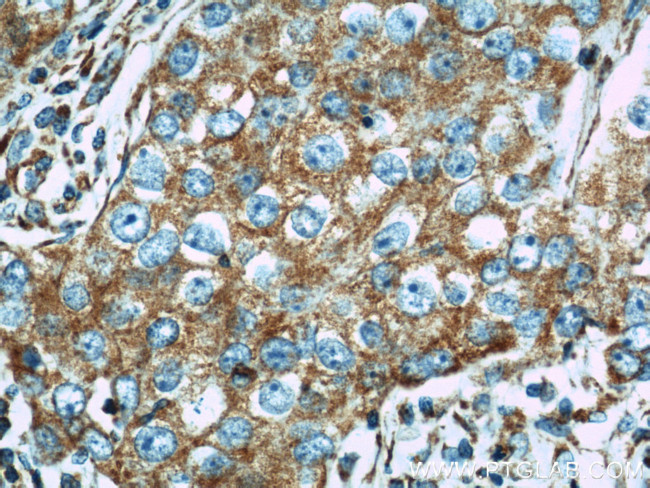 Mitofilin Antibody in Immunohistochemistry (Paraffin) (IHC (P))