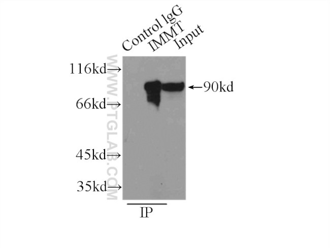 Mitofilin Antibody in Immunoprecipitation (IP)