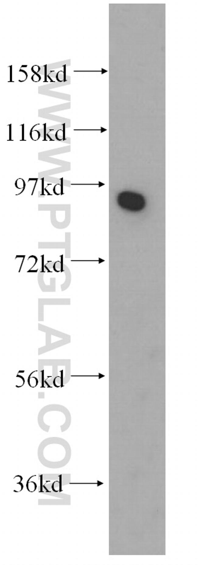 Mitofilin Antibody in Western Blot (WB)