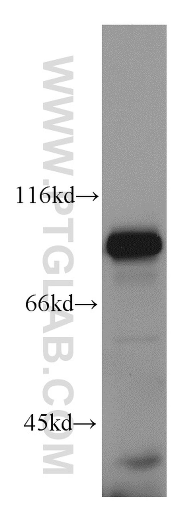 Mitofilin Antibody in Western Blot (WB)