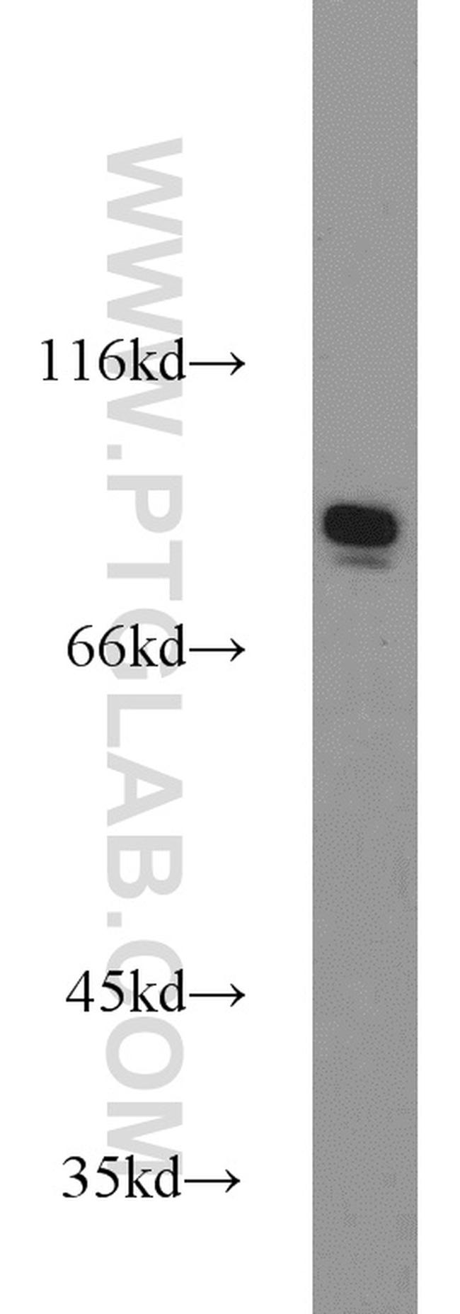 Mitofilin Antibody in Western Blot (WB)