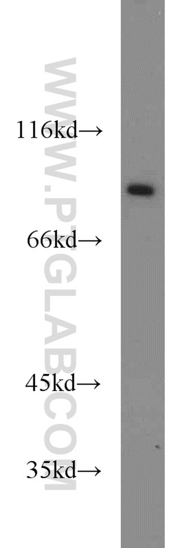 Mitofilin Antibody in Western Blot (WB)