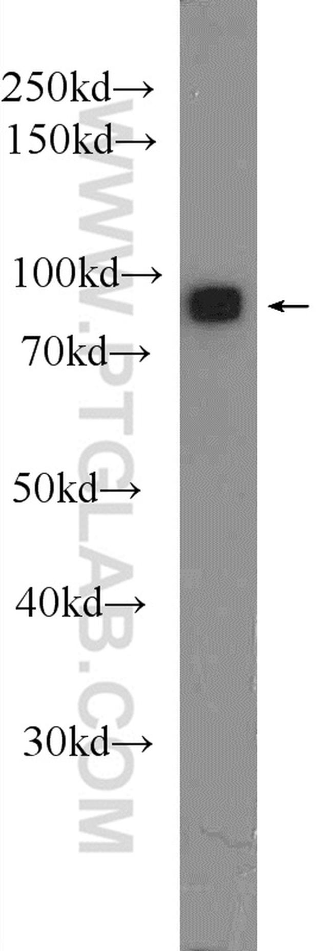 Mitofilin Antibody in Western Blot (WB)