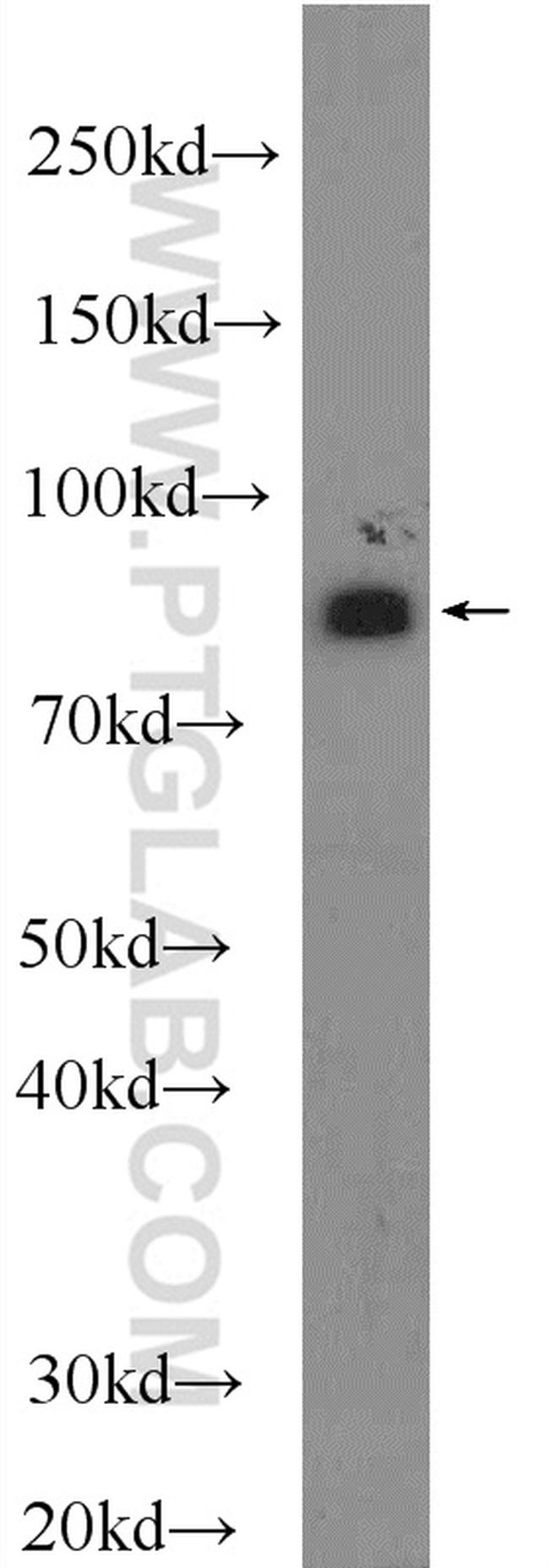 Mitofilin Antibody in Western Blot (WB)