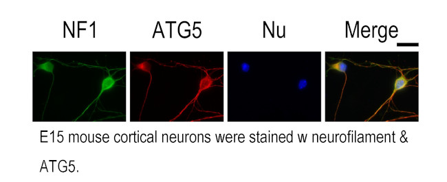 ATG5 Antibody in Immunocytochemistry (ICC/IF)