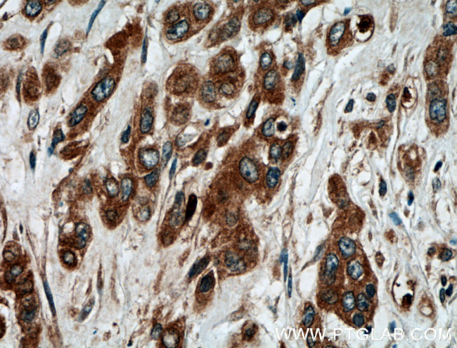 ATG5 Antibody in Immunohistochemistry (Paraffin) (IHC (P))