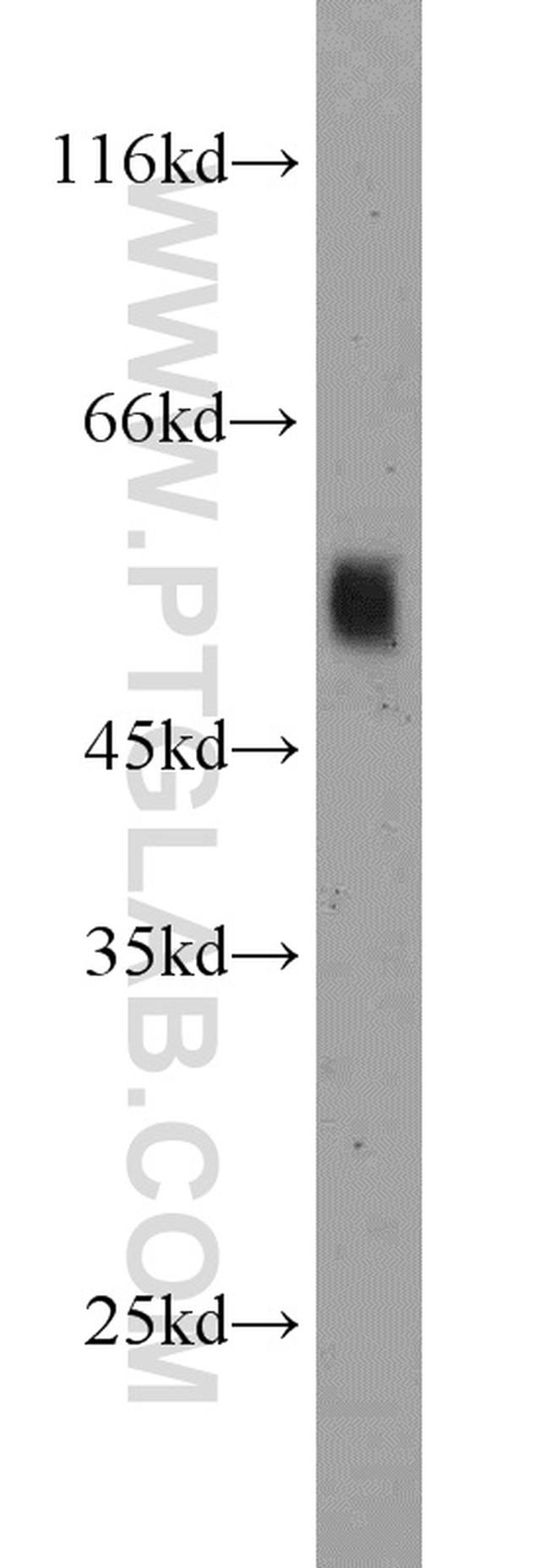 ATG5 Antibody in Western Blot (WB)