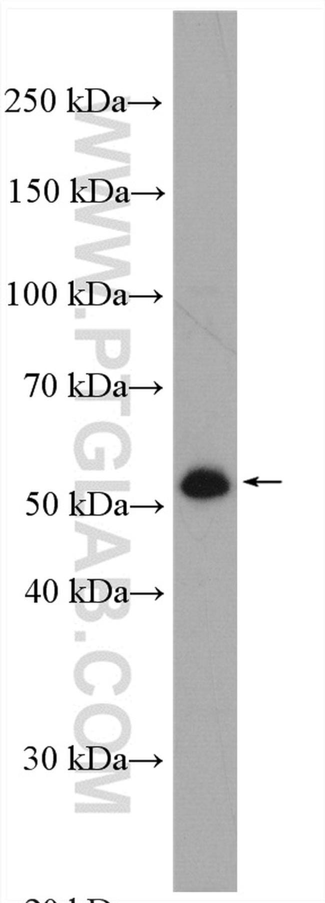 ATG5 Antibody in Western Blot (WB)