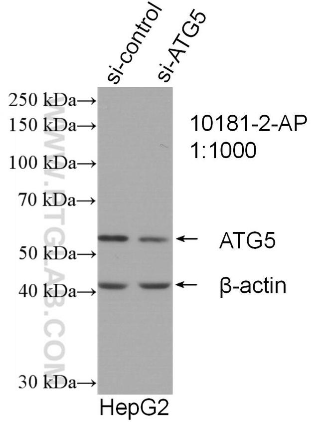 ATG5 Antibody in Western Blot (WB)