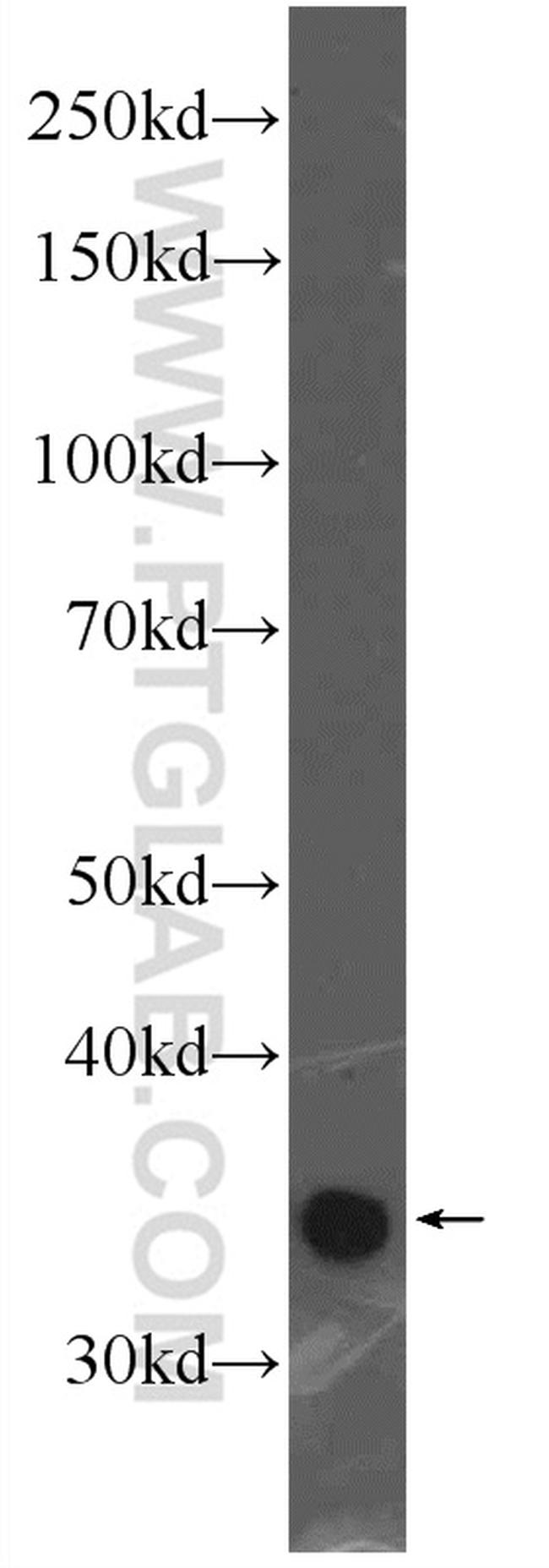 ATG5 Antibody in Western Blot (WB)