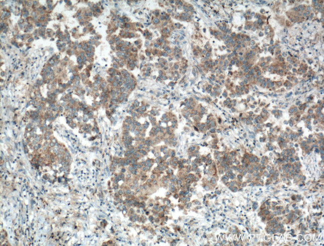 DCTN5 Antibody in Immunohistochemistry (Paraffin) (IHC (P))