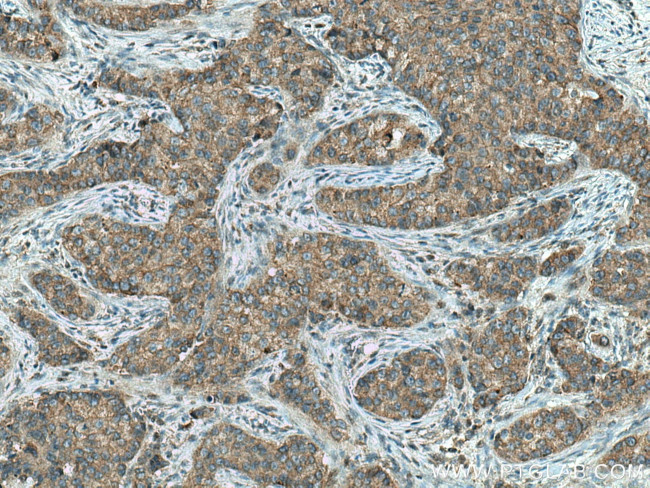 DCTN5 Antibody in Immunohistochemistry (Paraffin) (IHC (P))