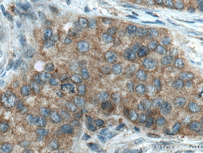 DCTN5 Antibody in Immunohistochemistry (Paraffin) (IHC (P))