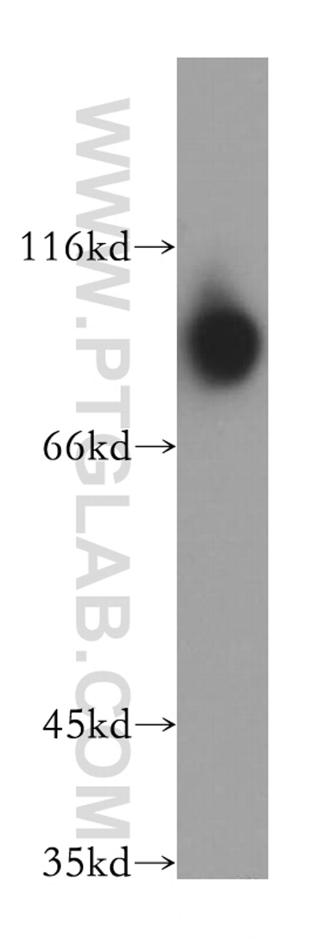 DIDO1 Antibody in Western Blot (WB)