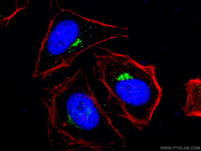 RAB6A Antibody in Immunocytochemistry (ICC/IF)