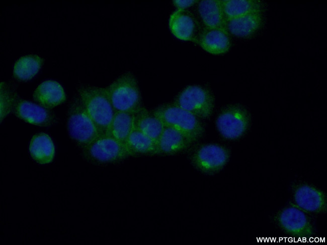 RAB6A Antibody in Immunocytochemistry (ICC/IF)