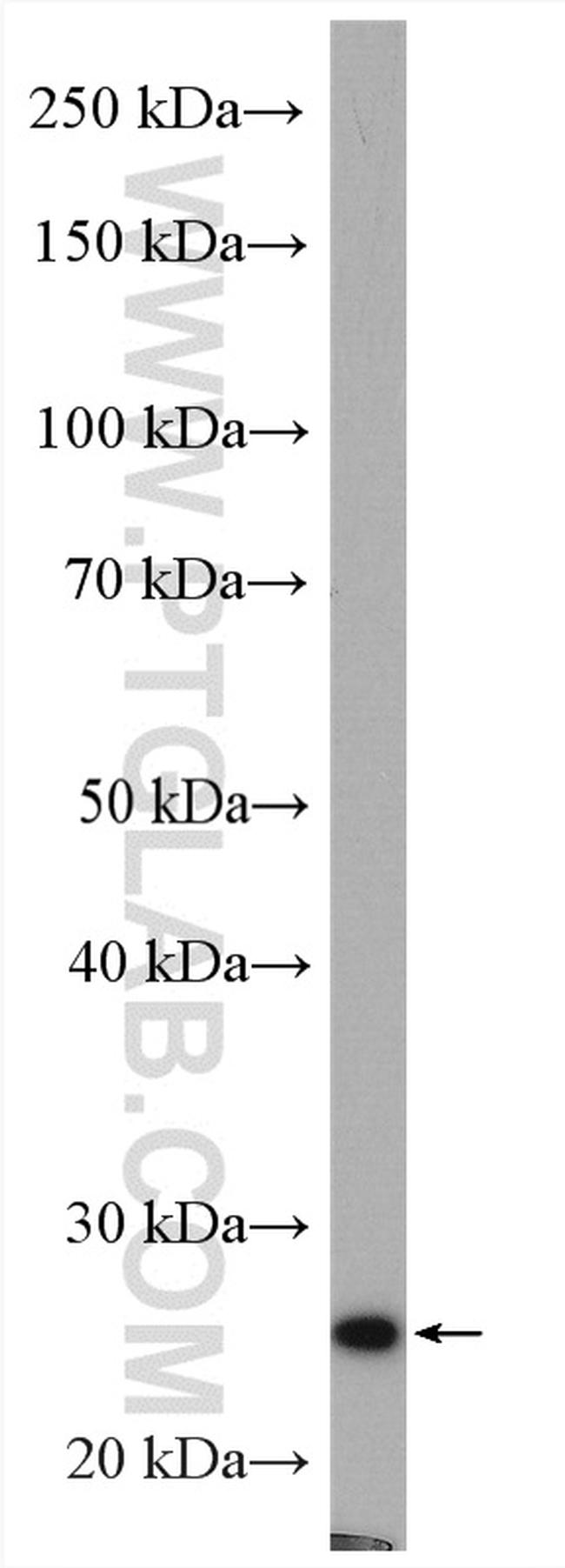 RAB6A Antibody in Western Blot (WB)