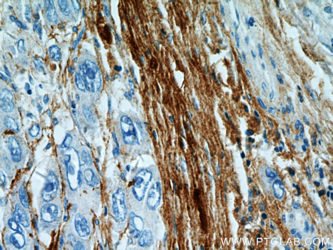 TGFBI / BIGH3 Antibody in Immunohistochemistry (Paraffin) (IHC (P))