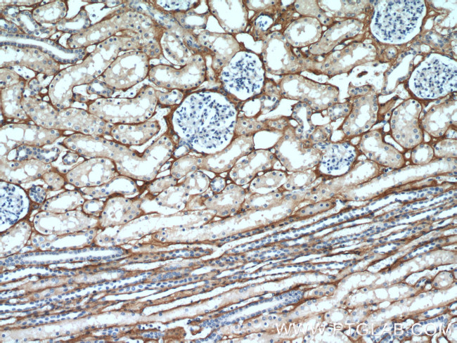 TGFBI / BIGH3 Antibody in Immunohistochemistry (Paraffin) (IHC (P))