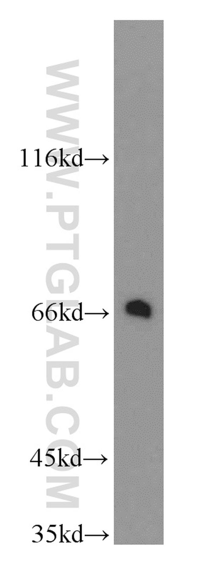 TGFBI / BIGH3 Antibody in Western Blot (WB)
