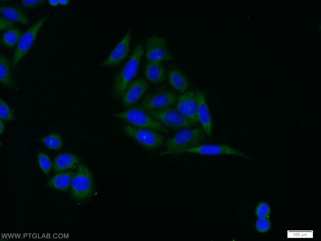 IGFBP3 Antibody in Immunocytochemistry (ICC/IF)